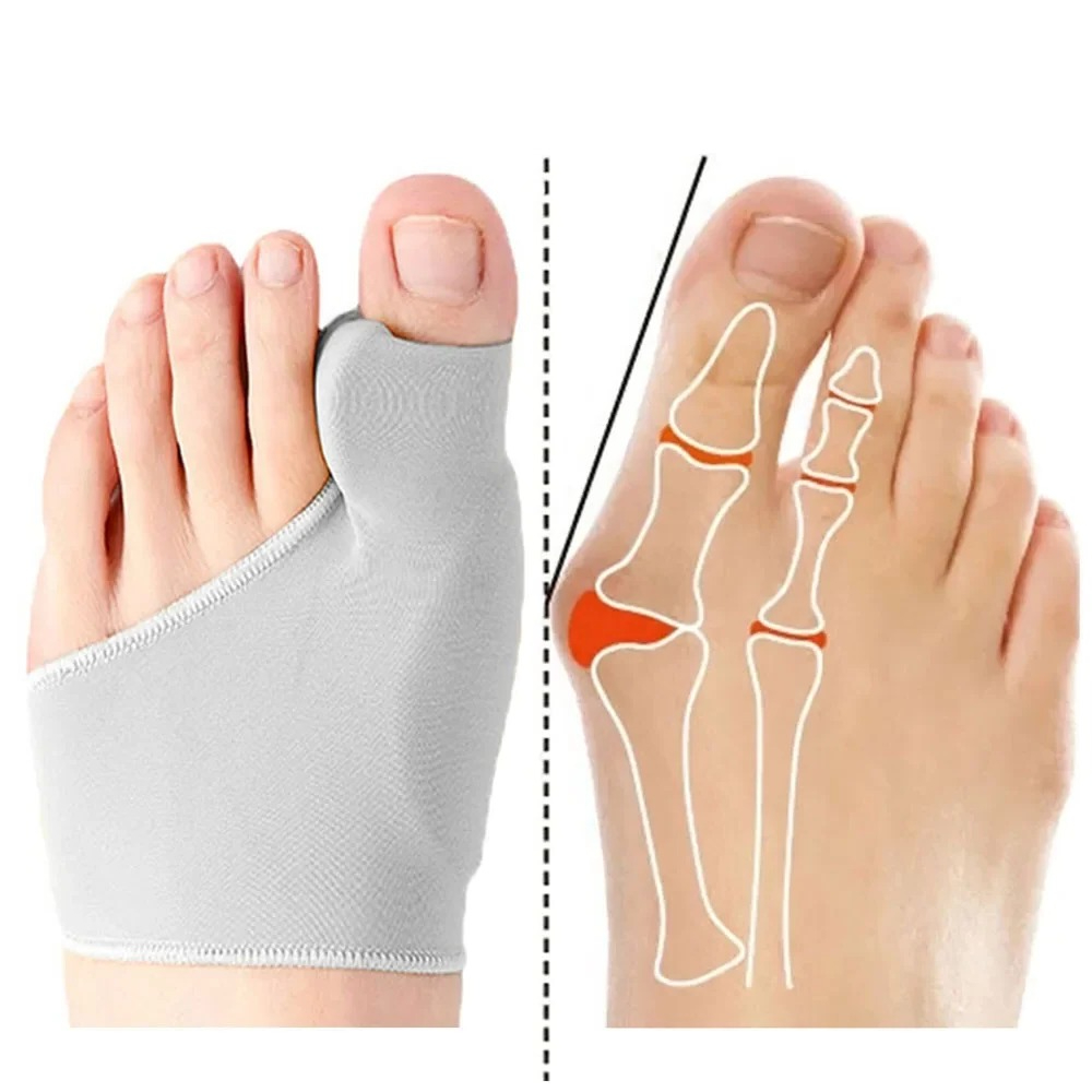 1/2Pair Toe Separator Hallux V - Ankle Brace Sock ulasan dan harga